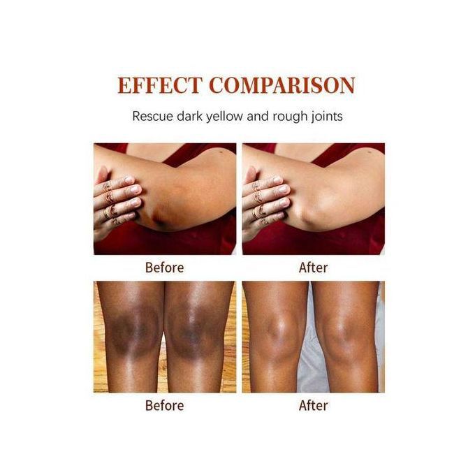 Whitening Dark Knuckles