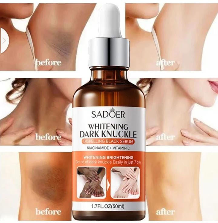 Whitening Dark Knuckles